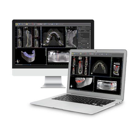 Digital Case Planning